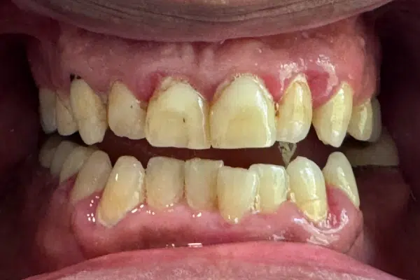 Image-3