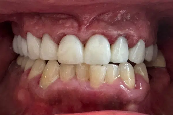 Image-4